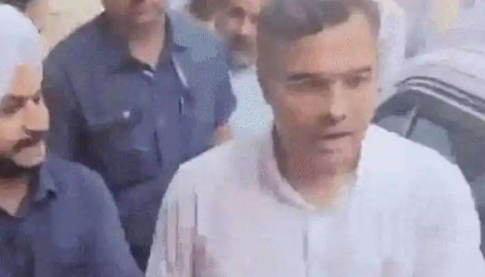 दिल्ली के मंत्री प्रवेश वर्मा ने युवक को जड़ा थप्पड़, बहसबाजी के बीच खोया आपा; केजरीवाल बोले- गिरफ्तार करो 1 aamaadmi.in