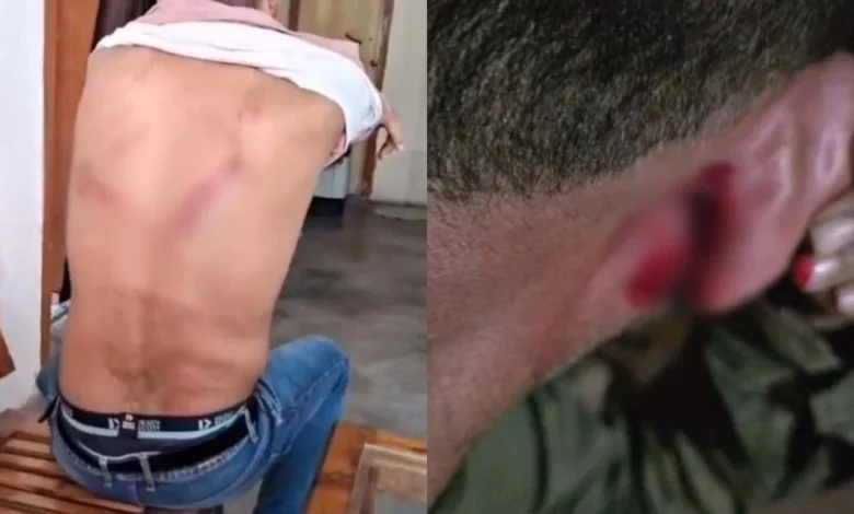 शिकार की सूचना पर जंगल पहुंचे वन अमले पर हमला: 40 से 50 महिला-पुरुषों ने रेंजर समेत 6 वनकर्मियों को बनाया बंधक, लाठी-डंडों से की मारपीट 1 aamaadmi.in